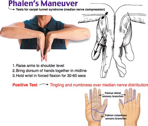 wrist flexion and median nerve compression test|carpal tunnel test maneuvers.